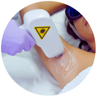 diódalézeres szőrtelenítő gép szépségszalonoknak – tartós szőrtelenítés professzionális technológiával