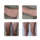 GlissContour 360 – Kompressziós, görgős testkezelő és arckezelő szalon gép