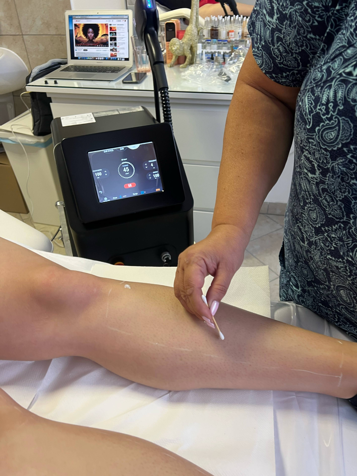 Szolnokon is a Dr.Katoki szalon gép mellett tették le a voksukat